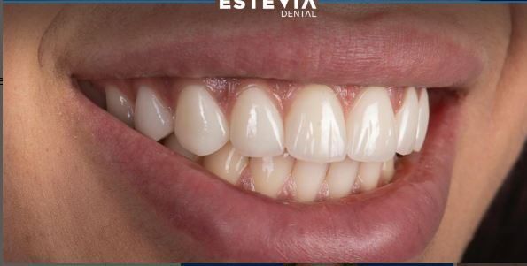 before-after