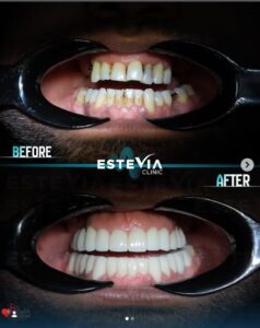 Best dentist in Antalya Dt Huseyin Ay EsteVia Clinic dental consultation