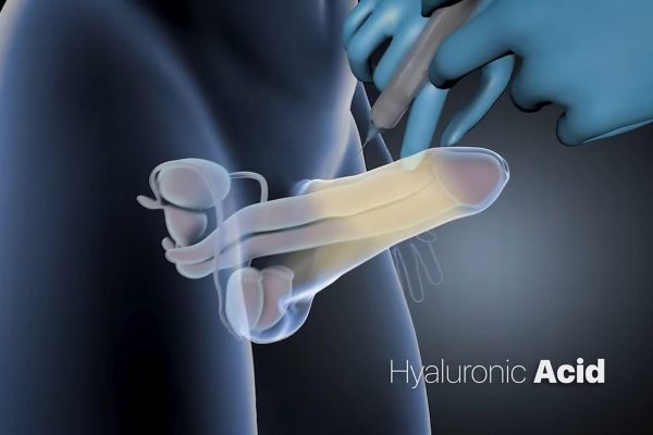 penile enlargement turkey